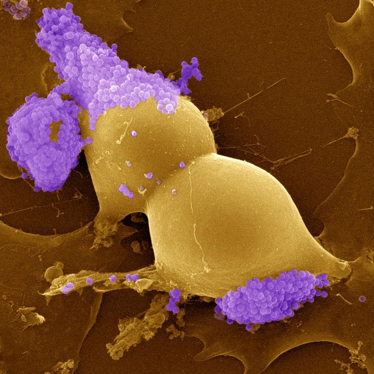 Ehrlichia ruminantium bacteria (purple) infecting a bovine aortic endothelial cell in the process of division © D. Meyer, CIRAD